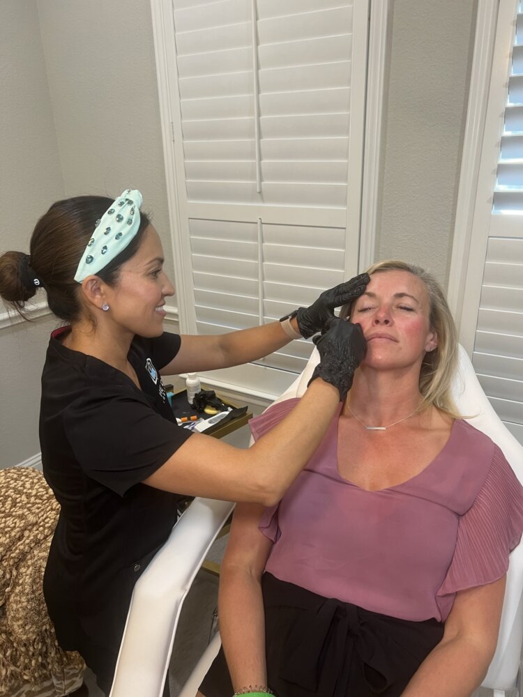 Microneedling For Fine Lines Peachtree City GA
